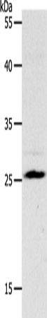 Western Blot analysis of Mouse liver tissue using NQO2 Polyclonal Antibody at dilution of 1:1200