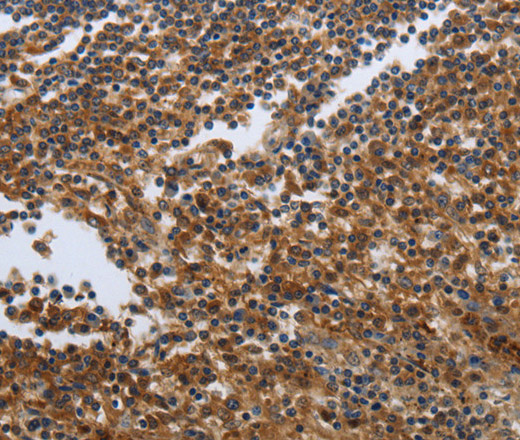 Immunohistochemistry of paraffin-embedded Human tonsil tissue using PDCD2 Polyclonal Antibody at dilution 1:50