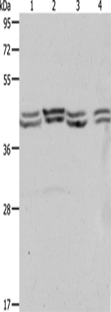Western Blot analysis of Hela, 293T, NIH/3T3 and Jurkat cell using PSMD6 Polyclonal Antibody at dilution of 1:650