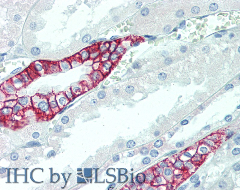 Immunohistochemistry of paraffin-embedded Kidney tissue using SCN10A Polyclonal Antibody at dilution of 1:100.