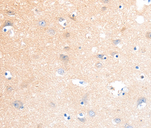 Immunohistochemistry of paraffin-embedded Human brain tissue using SLC22A17 Polyclonal Antibody at dilution 1:40