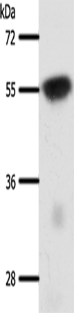 Western Blot analysis of Mouse brain tissue using SLC32A1 Polyclonal Antibody at dilution of 1:950