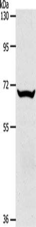 Western Blot analysis of Mouse liver tissue using SLC33A1 Polyclonal Antibody at dilution of 1:700