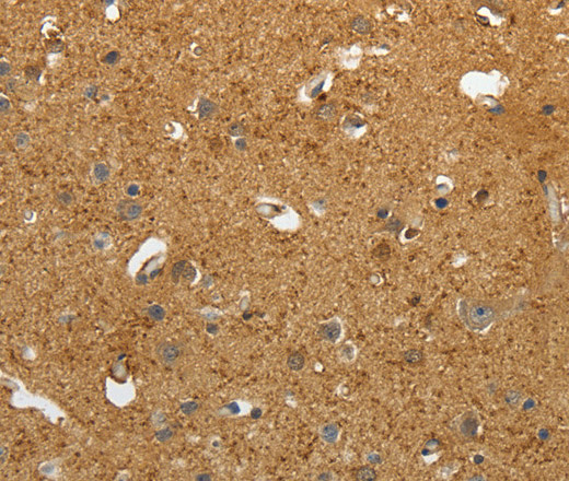 Immunohistochemistry of paraffin-embedded Human brain tissue using AKAP12 Polyclonal Antibody at dilution 1:40