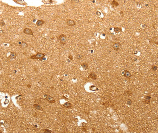 Immunohistochemistry of paraffin-embedded Human brain tissue using MAP1B  Polyclonal Antibody at dilution 1:60