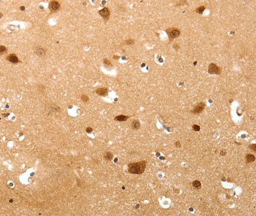 Immunohistochemistry of paraffin-embedded Human brain tissue using TNN Polyclonal Antibody at dilution 1:40