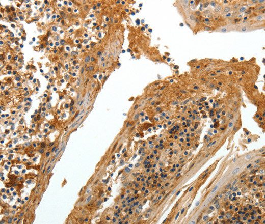 Immunohistochemistry of paraffin-embedded Human tonsil tissue using TNR Polyclonal Antibody at dilution 1:60