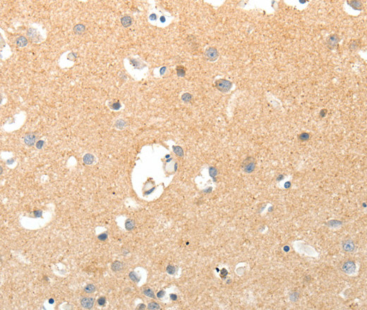 Immunohistochemistry of paraffin-embedded Human brain tissue using TNXB Polyclonal Antibody at dilution 1:40