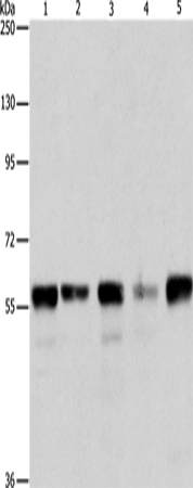 Western Blot analysis of Hela, Jurkat, 293T and K562 cell, Mouse testis tissue using ARIH2 Polyclonal Antibody at dilution of 1:550