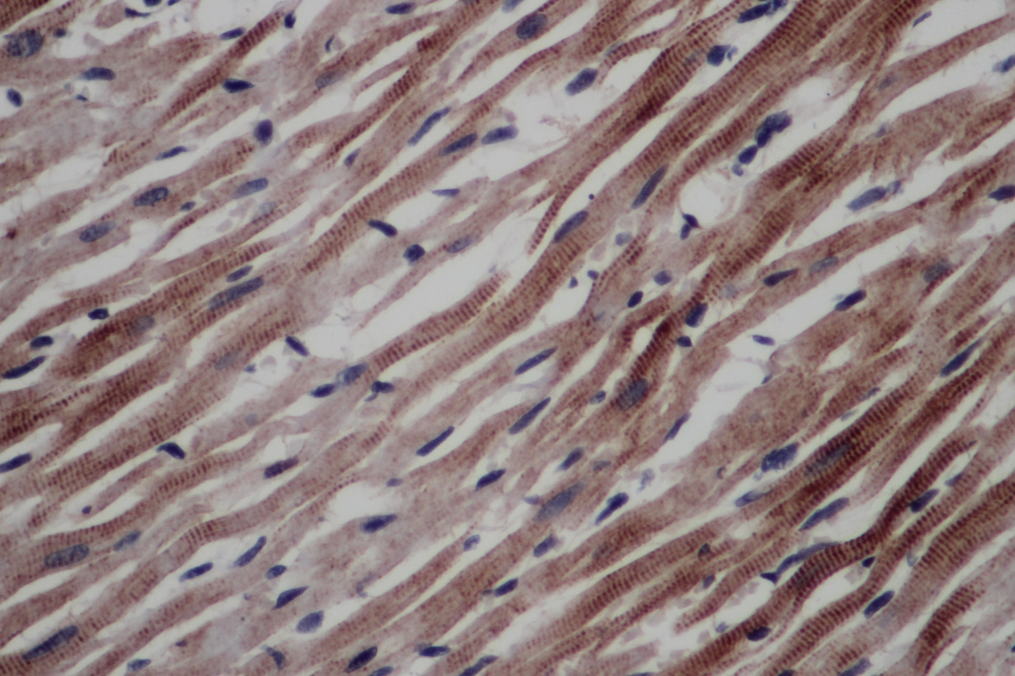 Immunohistochemistry of paraffin-embedded Rat heart using CD297 Polyclonal Antibody at dilution of 1:50