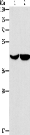 Western Blot analysis of Hela and hepG2 cell using ASPN Polyclonal Antibody at dilution of 1:550