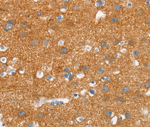 Immunohistochemistry of paraffin-embedded Human brain tissue using SNCA Polyclonal Antibody at dilution 1:30