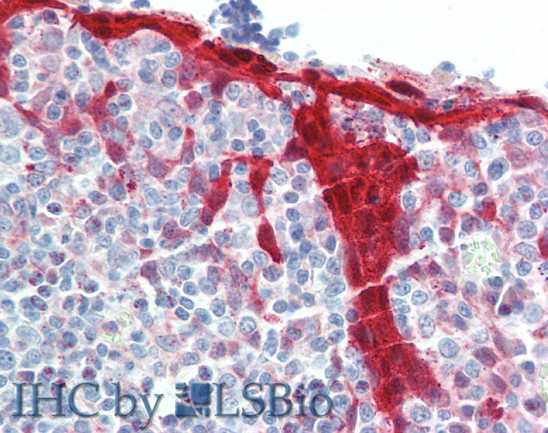 Immunohistochemistry of paraffin-embedded Tonsil tissue using NLRP7 Polyclonal Antibody at dilution of 1:100.