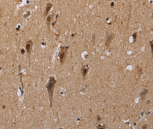 Immunohistochemistry of paraffin-embedded Human brain  using GTF2I Polyclonal Antibody at dilution of 1:40