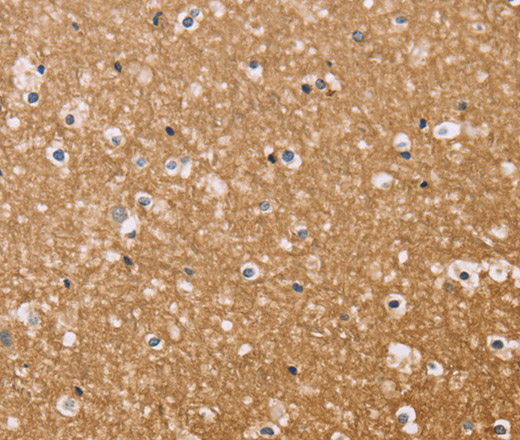 Immunohistochemistry of paraffin-embedded Human brain  using BGLAP Polyclonal Antibody at dilution of 1:40