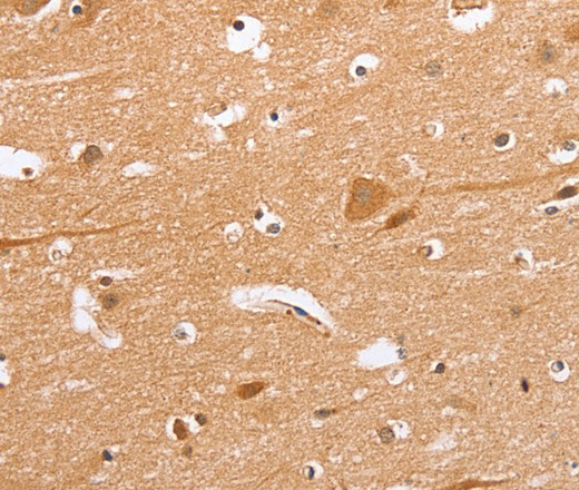 Immunohistochemistry of paraffin-embedded Human brain  tissue using BLNK Polyclonal Antibody at dilution 1:50