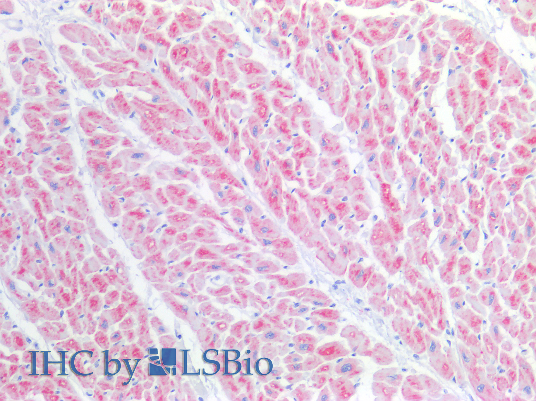 Immunohistochemistry of paraffin-embedded Human heart tissue using BST1 Polyclonal Antibody at dilution of 1:100.