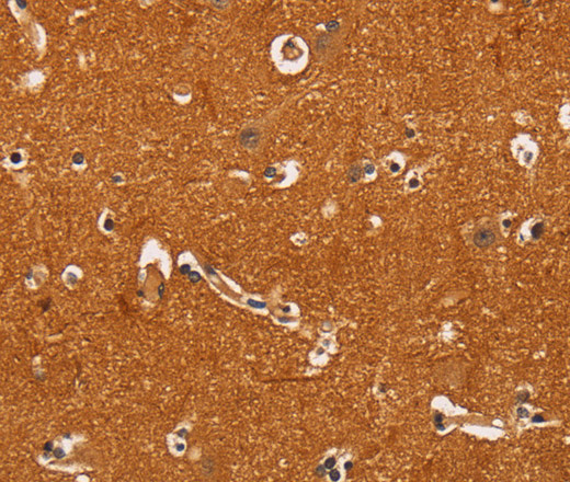 Immunohistochemistry of paraffin-embedded Human brain  tissue using TNFRSF8 Polyclonal Antibody at dilution 1:60