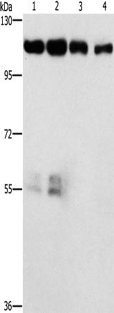 Western Blot analysis of Hela and hepG2 cell, lovo cell and Human colon cancer tissue using CDK11B Polyclonal Antibody at dilution of 1:750