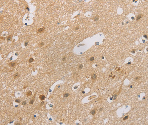 Immunohistochemistry of paraffin-embedded Human brain tissue using p16 Polyclonal Antibody at dilution 1:60