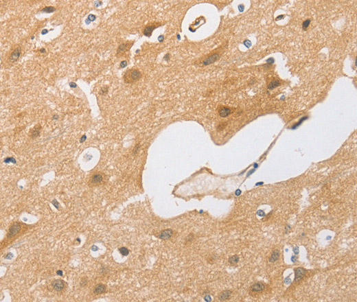 Immunohistochemistry of paraffin-embedded Human brain tissue using CEBP beta Polyclonal Antibody at dilution 1:60