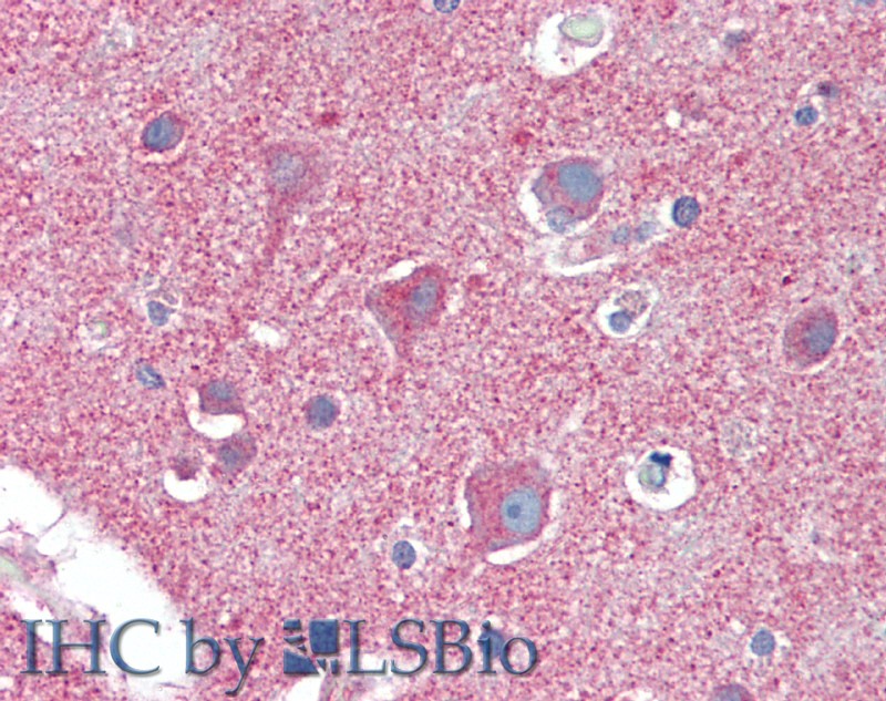 Immunohistochemistry of paraffin-embedded Brain, Cortex tissue using CLTC Polyclonal Antibody at dilution of 1:60.