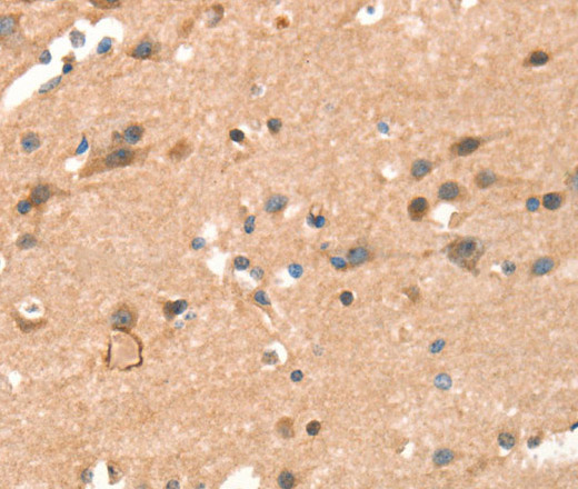 Immunohistochemistry of paraffin-embedded Human brain  using CRELD1 Polyclonal Antibody at dilution of 1:40