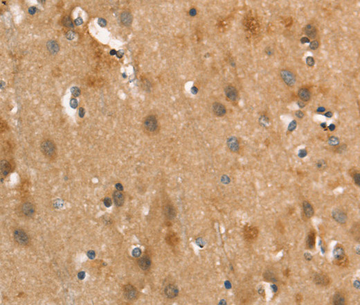 Immunohistochemistry of paraffin-embedded Human brain  using CALCRL Polyclonal Antibody at dilution of 1:40