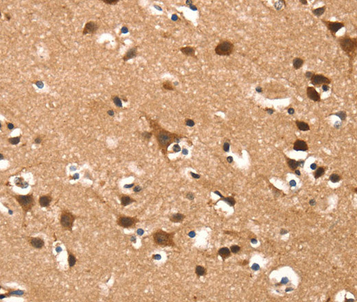 Immunohistochemistry of paraffin-embedded Human brain  using DAAM1 Polyclonal Antibody at dilution of 1:50