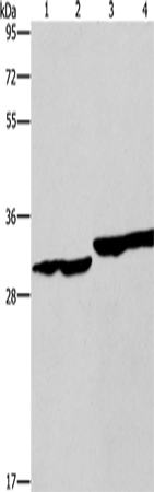 Western Blot analysis of Human endometrial carcinoma and colon cancer tissue, Human fetal liver tissue and PC3 cell using DECR1 Polyclonal Antibody at dilution of 1:300