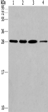 Western Blot analysis of Hela cell and Human fetal liver tissue, A549 and 293T cell using ERP29 Polyclonal Antibody at dilution of 1:200