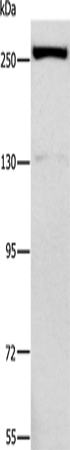 Western Blot analysis of Raji cell using ESPL1 Polyclonal Antibody at dilution of 1:500