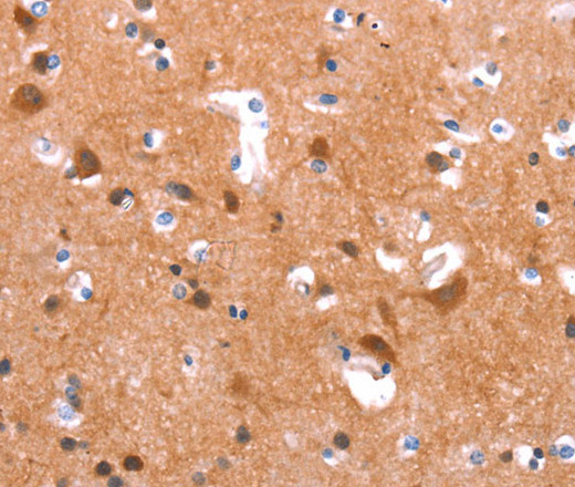 Immunohistochemistry of paraffin-embedded Human brain  tissue using GAS8 Polyclonal Antibody at dilution 1:40