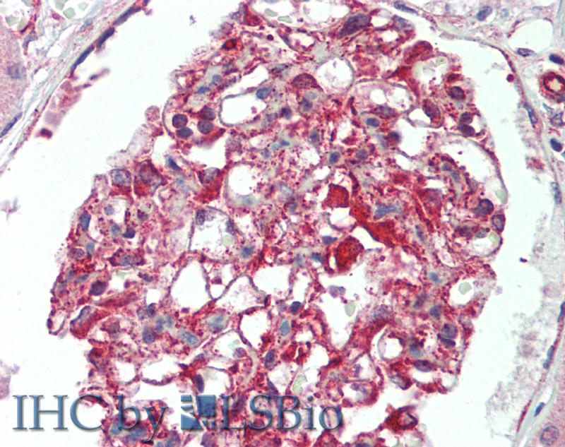 Immunohistochemistry of paraffin-embedded Kidney tissue using IL17RB Polyclonal Antibody at dilution of 1:120 .