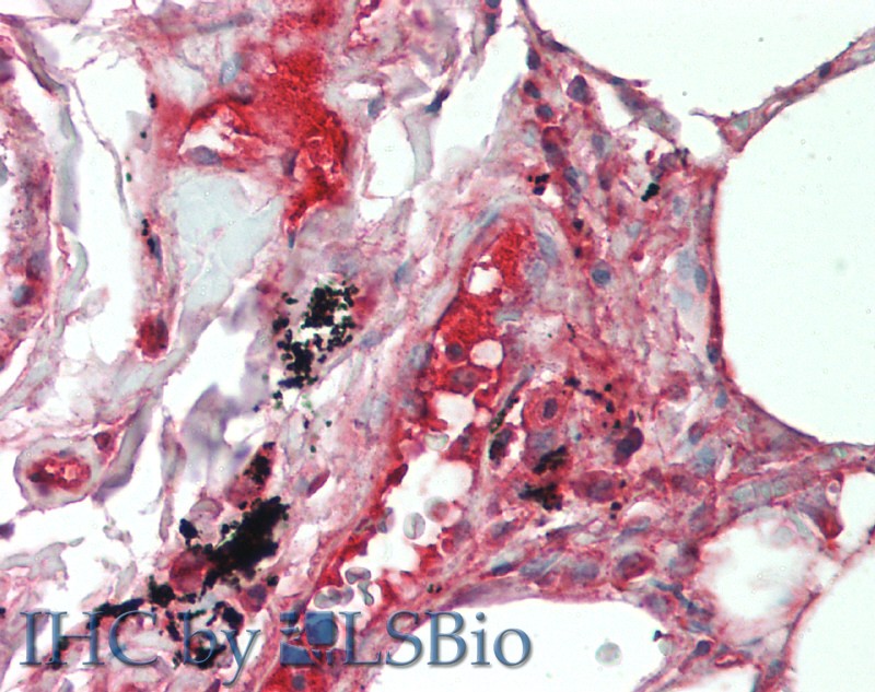 Immunohistochemistry of paraffin-embedded Lung tissue using IL19 Polyclonal Antibody at dilution of 1:90 .