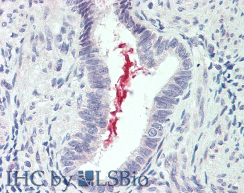 Immunohistochemistry of paraffin-embedded Lung tissue using IL19 Polyclonal Antibody at dilution of 1:90 .