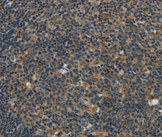 Immunohistochemistry of paraffin-embedded Human tonsil using SYN1 Polyclonal Antibody at dilution of 1:40