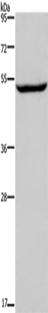 Western Blot analysis of Raji cell using IMPDH1 Polyclonal Antibody at dilution of 1:450