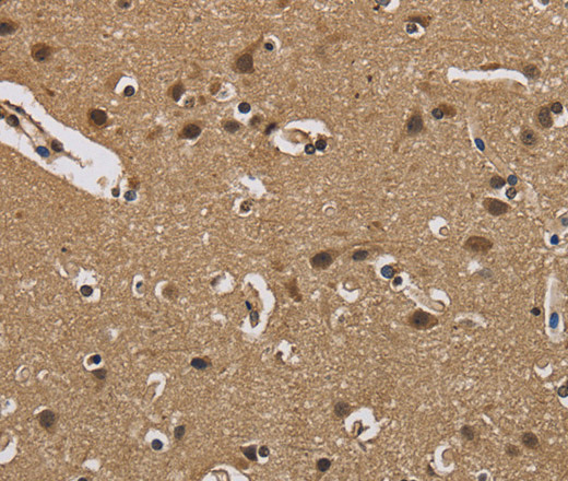 Immunohistochemistry of paraffin-embedded Human brain  using FABP2 Polyclonal Antibody at dilution of 1:40