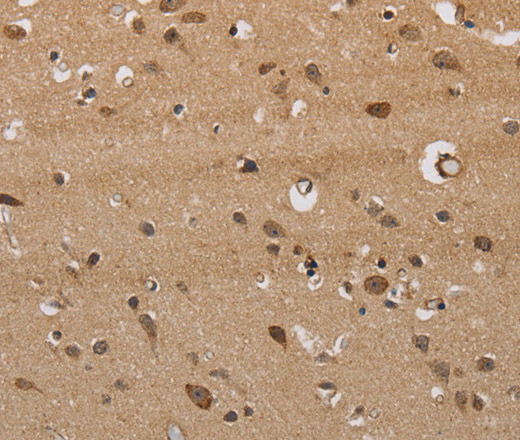 Immunohistochemistry of paraffin-embedded Human brain  tissue using ITPR3 Polyclonal Antibody at dilution 1:40