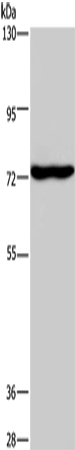 Western Blot analysis of Mouse brain tissue using KCND1 Polyclonal Antibody at dilution of 1:400