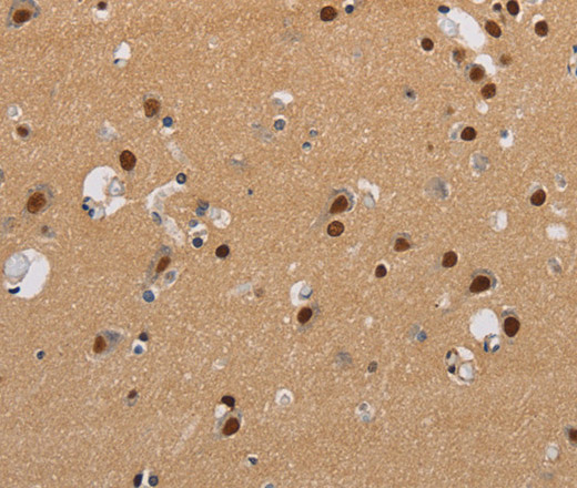 Immunohistochemistry of paraffin-embedded Human brain  using KCNG4 Polyclonal Antibody at dilution of 1:40