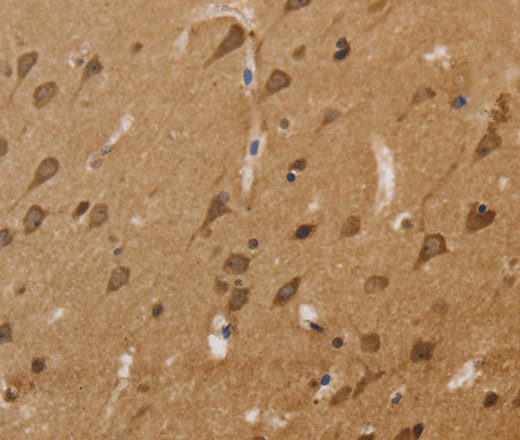 Immunohistochemistry of paraffin-embedded Human brain  tissue using KCNN4 Polyclonal Antibody at dilution 1:50