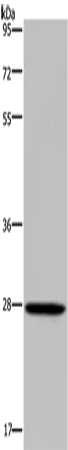Western Blot analysis of Mouse spleen tissue using KLK14 Polyclonal Antibody at dilution of 1:300