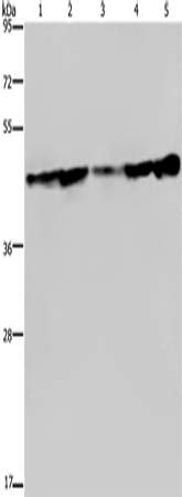 Western Blot analysis of Human fetal liver tissue, HT-29 and HUVEC cell, MCF-7 cell and Human hepatocellular carcinoma tissue using CERS4 Polyclonal Antibody at dilution of 1:300