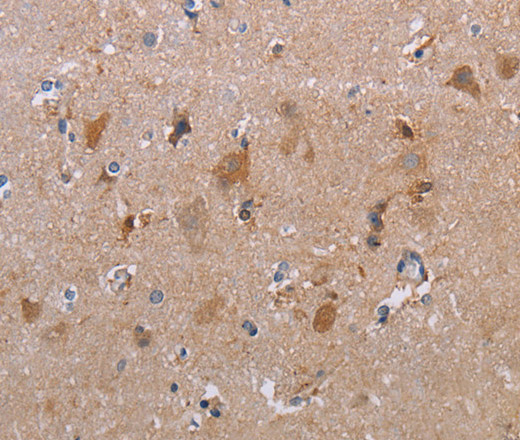 Immunohistochemistry of paraffin-embedded Human brain using MAGEF1 Polyclonal Antibody at dilution of 1:30