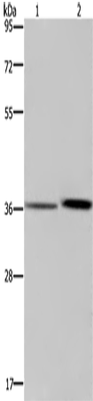 Western Blot analysis of A549 cell and Human fetal liver tissue using MAGEF1 Polyclonal Antibody at dilution of 1:300