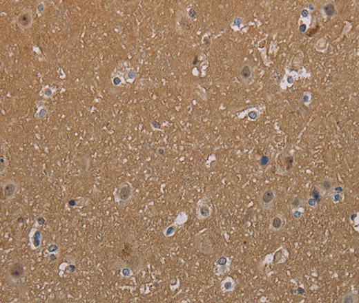 Immunohistochemistry of paraffin-embedded Human brain tissue using MAGEL2 Polyclonal Antibody at dilution 1:40