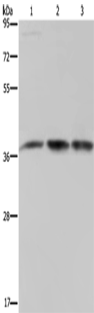 Western Blot analysis of 293T and LoVo cell, Human brain malignant glioma tissue using CAB39 Polyclonal Antibody at dilution of 1:450