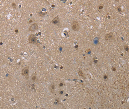 Immunohistochemistry of paraffin-embedded Human brain  tissue using MGLL Polyclonal Antibody at dilution 1:40